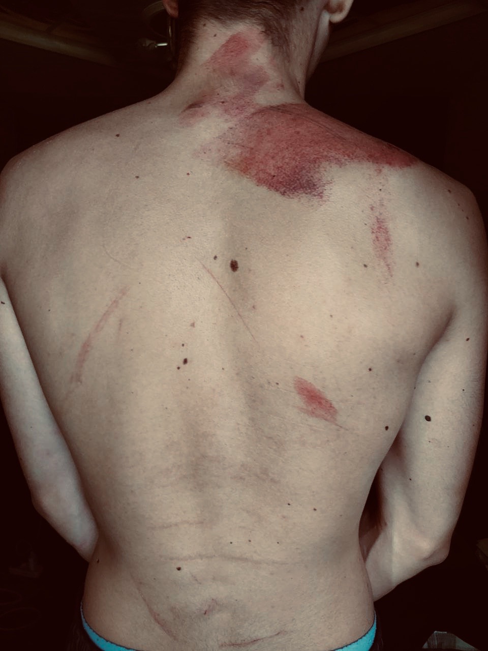 Має янгола-охоронця: у Кривому Розі чоловік вижив після двох обстрілів -